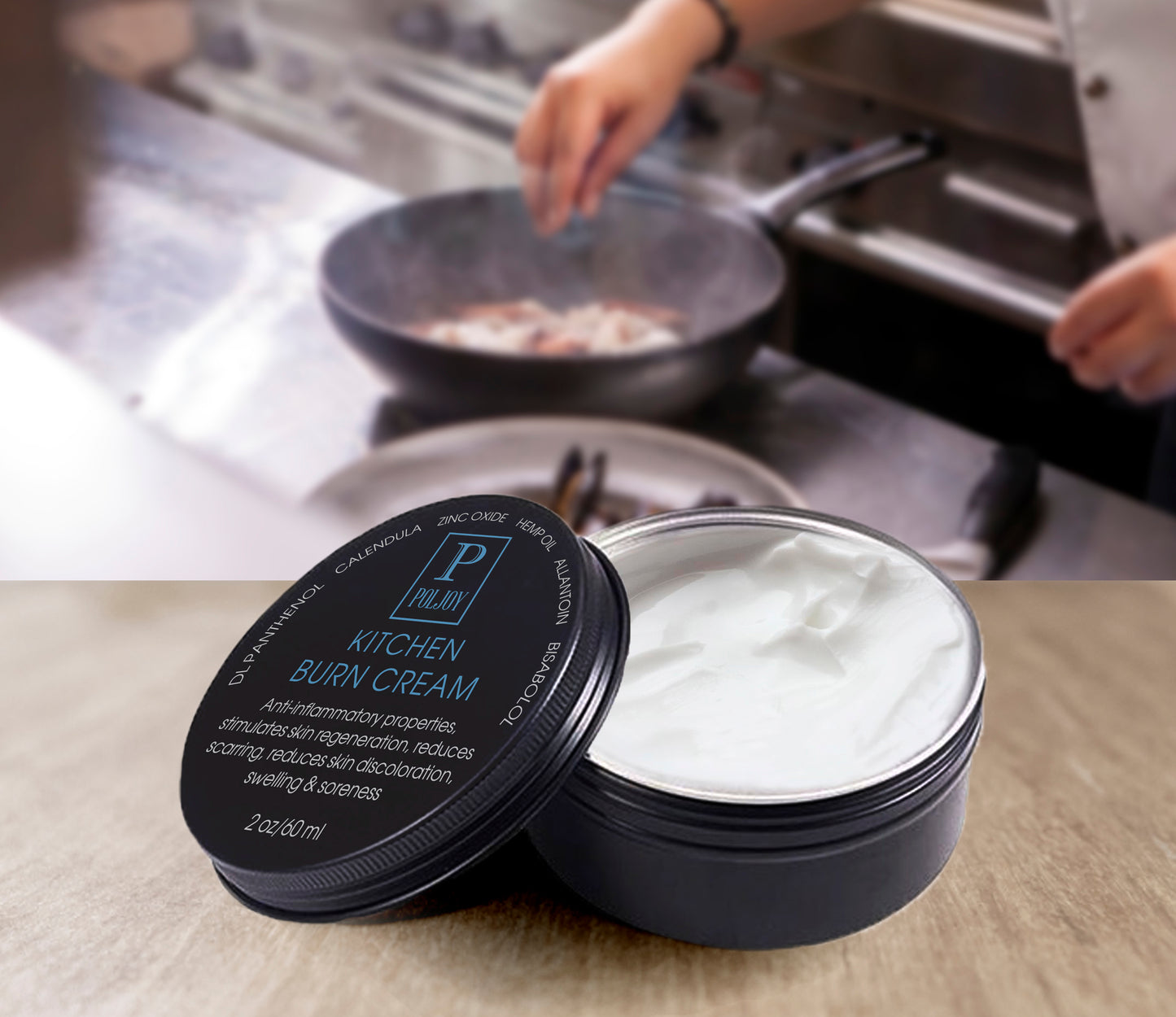 After Burns Cream