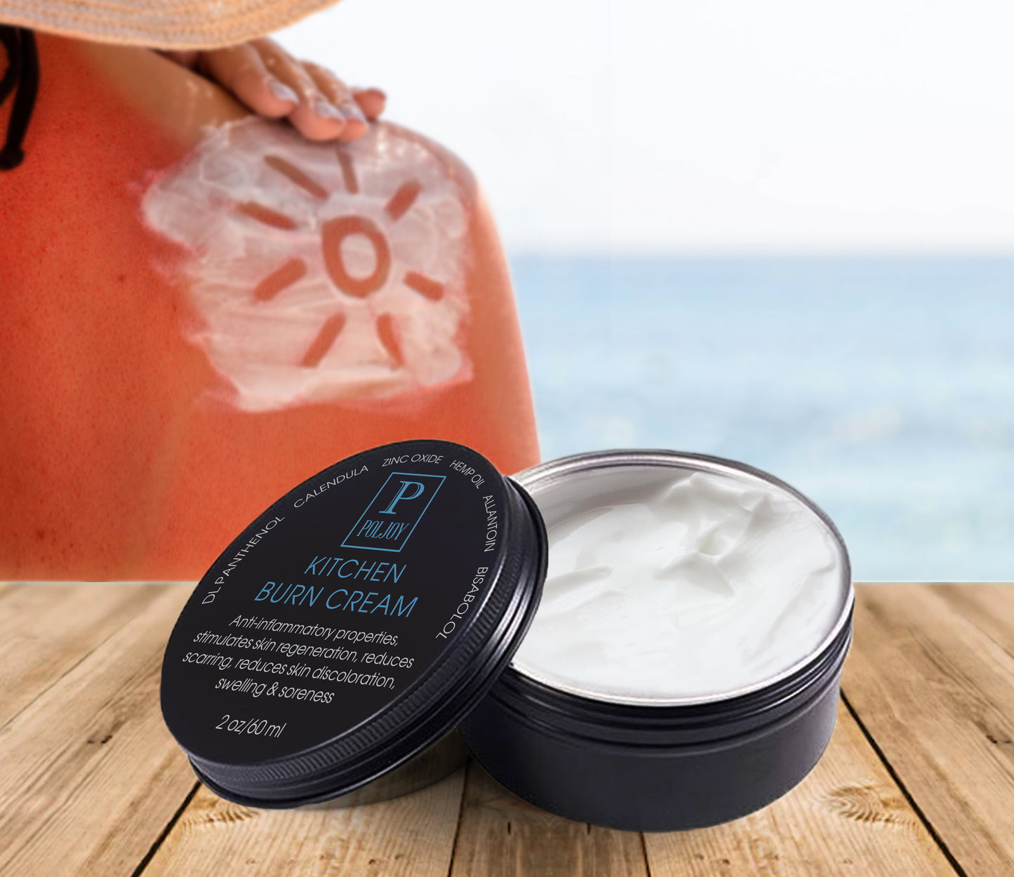 After Burns Cream