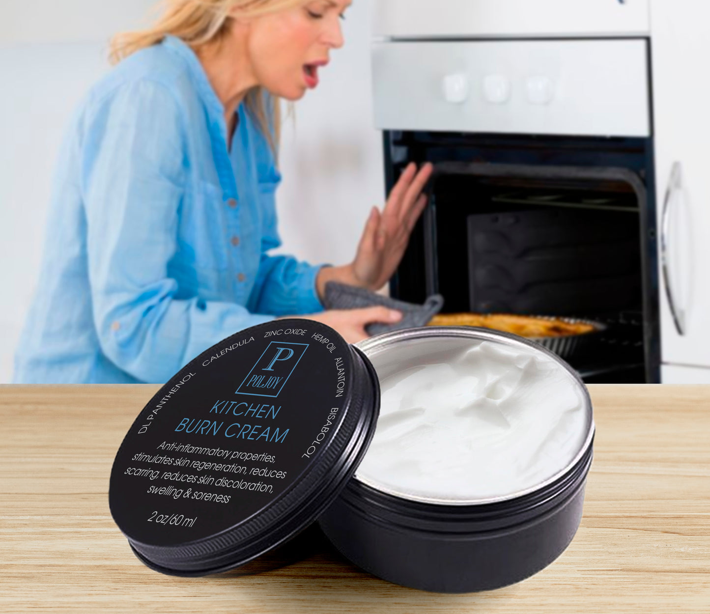 After Burns Cream